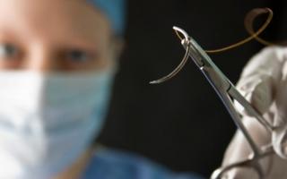 Виды хирургических швов и техника их наложения Виды узлов в хирургии